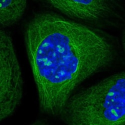 MEK5 Antibody, Novus Biologicals:Antibodies:Primary Antibodies